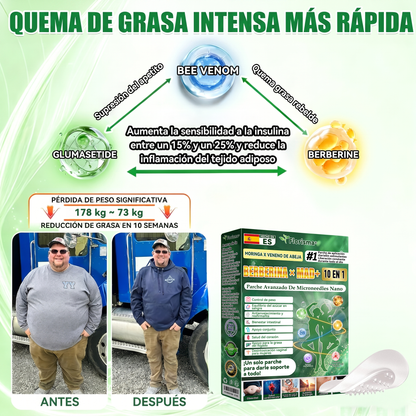 𝑇𝑖𝑒𝑛𝑑𝑎 𝑜𝑓𝑖𝑐𝑖𝑎𝑙 𝑑𝑒 𝐸𝑠𝑝𝑎ñ𝑎 🇪🇸  | 🐟𝐅𝐥𝐨𝐫𝐢𝐬𝐦𝐚® 𝑴𝒐𝒓𝒊𝒏𝒈𝒂 𝑩𝒆𝒓𝒃𝒆𝒓𝒊𝒏𝒂 10 𝑬𝒏 1 𝑷𝒂𝒓𝒄𝒉𝒆 𝑨𝒗𝒂𝒏𝒛𝒂𝒅𝒐 𝑫𝒆 𝑴𝒊𝒄𝒓𝒐𝒏𝒆𝒆𝒅𝒍𝒆𝒔 𝑵𝒂𝒏𝒐