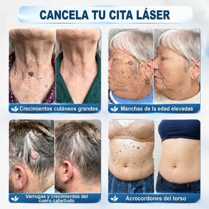 👩🏻‍🔬𝐏𝐢𝐜𝐝𝐨® Borrador de Verrugas y Manchas en 7 Días (𝐀𝐩𝐥𝐢𝐜𝐚𝐝𝐨𝐫 𝐫𝐨𝐥𝐥-𝐨𝐧: 𝐬𝐢𝐧 𝐝𝐨𝐥𝐨𝐫 𝐧𝐢 𝐜𝐢𝐜𝐚𝐭𝐫𝐢𝐜𝐞𝐬)✨