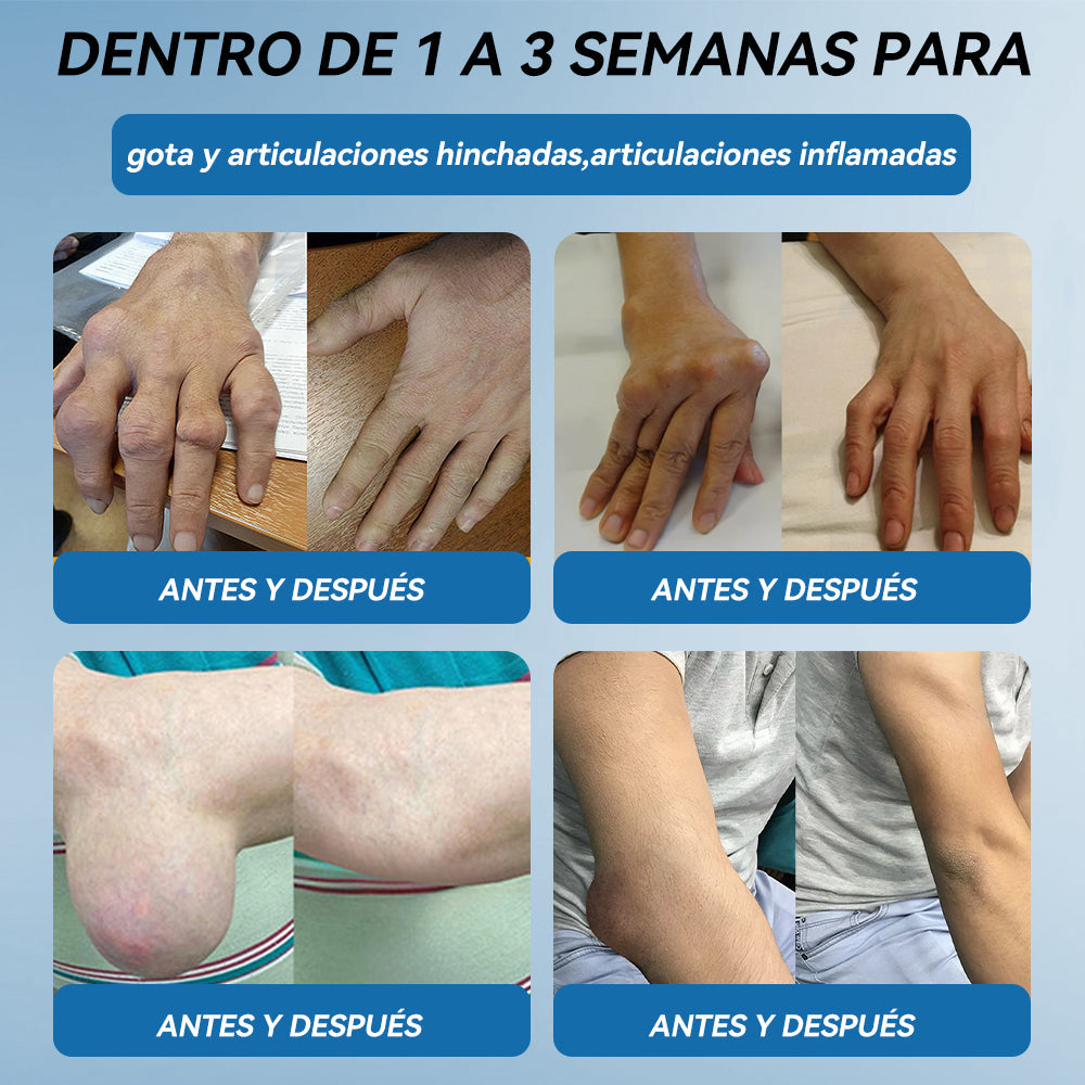 𝐓𝐢𝐞𝐧𝐝𝐚 𝐨𝐟𝐢𝐜𝐢𝐚𝐥 | 👩‍⚕️🎁𝖯𝗂𝖼𝗱𝗼® 𝐵𝑃𝐶-157 𝐶𝑟𝑒𝑚𝑎 𝒅𝒆 𝑹𝒆𝒄𝒖𝒑𝒆𝒓𝒂𝒄𝒊ó𝒏 𝖠𝗋𝗍𝗂𝖼𝗎𝗅𝖺𝗋🦴𝑇𝑟𝑎𝑡𝑎 𝑙𝑎 𝑎𝑟𝑡𝑟𝑖𝑡𝑖𝑠, 𝑙𝑎 𝑛𝑒𝑢𝑟𝑜𝑝𝑎𝑡í𝑎, 𝑒𝑙 𝑟𝑒𝑢𝑚𝑎𝑡𝑖𝑠𝑚𝑜, 𝑙𝑎𝑠 𝑙𝑒𝑠𝑖𝑜𝑛𝑒𝑠 𝑑𝑒𝑝𝑜𝑟𝑡𝑖𝑣𝑎𝑠 𝑦 𝑚á𝑠.👍