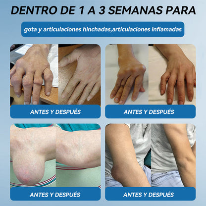 𝐓𝐢𝐞𝐧𝐝𝐚 𝐨𝐟𝐢𝐜𝐢𝐚𝐥 | 👩‍⚕️🎁𝖯𝗂𝖼𝗱𝗼® 𝐵𝑃𝐶-157 𝐶𝑟𝑒𝑚𝑎 𝒅𝒆 𝑹𝒆𝒄𝒖𝒑𝒆𝒓𝒂𝒄𝒊ó𝒏 𝖠𝗋𝗍𝗂𝖼𝗎𝗅𝖺𝗋🦴𝑇𝑟𝑎𝑡𝑎 𝑙𝑎 𝑎𝑟𝑡𝑟𝑖𝑡𝑖𝑠, 𝑙𝑎 𝑛𝑒𝑢𝑟𝑜𝑝𝑎𝑡í𝑎, 𝑒𝑙 𝑟𝑒𝑢𝑚𝑎𝑡𝑖𝑠𝑚𝑜, 𝑙𝑎𝑠 𝑙𝑒𝑠𝑖𝑜𝑛𝑒𝑠 𝑑𝑒𝑝𝑜𝑟𝑡𝑖𝑣𝑎𝑠 𝑦 𝑚á𝑠.👍