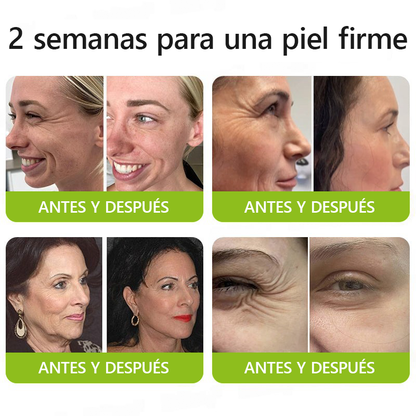 ✨✅𝐑𝐞𝐜𝐮𝐩𝐞𝐫𝐚 𝐥𝐚 𝐩𝐢𝐞𝐥 𝐣𝐨𝐯𝐞𝐧 𝐚𝐡𝐨𝐫𝐚 🍀𝐒𝐓𝐃𝐄𝐈®𝐁𝐎𝐓𝐎𝐗 & 𝐕𝐈𝐓𝐀𝐌𝐈𝐍𝐀 𝐀 𝐋𝐍𝐘𝐄𝐂𝐂𝐈Ó𝐍 𝐃𝐄 𝐑𝐄𝐓𝐈𝐍𝐎𝐋 𝐑𝐞𝐚𝐟𝐢𝐫𝐦𝐚𝐧𝐭𝐞 𝐀𝐧𝐭𝐢𝐚𝐫𝐮𝐠𝐚𝐬 𝐂𝐫𝐞𝐦𝐚