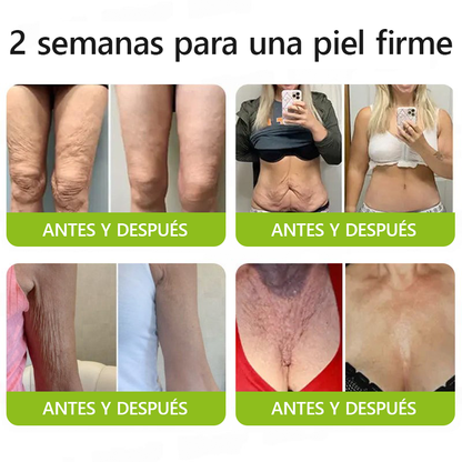 ✨✅𝐑𝐞𝐜𝐮𝐩𝐞𝐫𝐚 𝐥𝐚 𝐩𝐢𝐞𝐥 𝐣𝐨𝐯𝐞𝐧 𝐚𝐡𝐨𝐫𝐚 🍀𝐒𝐓𝐃𝐄𝐈®𝐁𝐎𝐓𝐎𝐗 & 𝐕𝐈𝐓𝐀𝐌𝐈𝐍𝐀 𝐀 𝐋𝐍𝐘𝐄𝐂𝐂𝐈Ó𝐍 𝐃𝐄 𝐑𝐄𝐓𝐈𝐍𝐎𝐋 𝐑𝐞𝐚𝐟𝐢𝐫𝐦𝐚𝐧𝐭𝐞 𝐀𝐧𝐭𝐢𝐚𝐫𝐮𝐠𝐚𝐬 𝐂𝐫𝐞𝐦𝐚