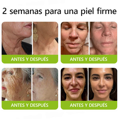 ✨✅𝐑𝐞𝐜𝐮𝐩𝐞𝐫𝐚 𝐥𝐚 𝐩𝐢𝐞𝐥 𝐣𝐨𝐯𝐞𝐧 𝐚𝐡𝐨𝐫𝐚 🍀𝐒𝐓𝐃𝐄𝐈®𝐁𝐎𝐓𝐎𝐗 & 𝐕𝐈𝐓𝐀𝐌𝐈𝐍𝐀 𝐀 𝐋𝐍𝐘𝐄𝐂𝐂𝐈Ó𝐍 𝐃𝐄 𝐑𝐄𝐓𝐈𝐍𝐎𝐋 𝐑𝐞𝐚𝐟𝐢𝐫𝐦𝐚𝐧𝐭𝐞 𝐀𝐧𝐭𝐢𝐚𝐫𝐮𝐠𝐚𝐬 𝐂𝐫𝐞𝐦𝐚