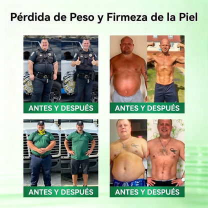 𝑇𝑖𝑒𝑛𝑑𝑎 𝑜𝑓𝑖𝑐𝑖𝑎𝑙 𝑑𝑒 𝐸𝑠𝑝𝑎ñ𝑎 🇪🇸  | 🐟𝐅𝐥𝐨𝐫𝐢𝐬𝐦𝐚® 𝑴𝒐𝒓𝒊𝒏𝒈𝒂 𝑩𝒆𝒓𝒃𝒆𝒓𝒊𝒏𝒂 10 𝑬𝒏 1 𝑷𝒂𝒓𝒄𝒉𝒆 𝑨𝒗𝒂𝒏𝒛𝒂𝒅𝒐 𝑫𝒆 𝑴𝒊𝒄𝒓𝒐𝒏𝒆𝒆𝒅𝒍𝒆𝒔 𝑵𝒂𝒏𝒐